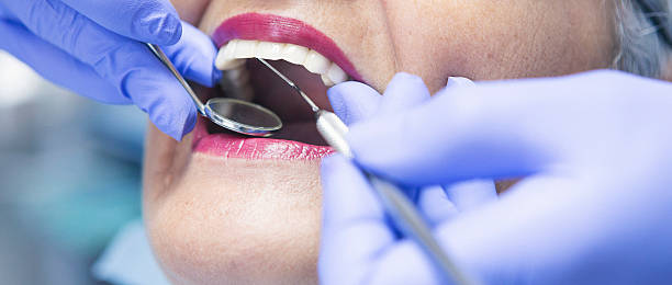 Best Knocked-Out Tooth (Avulsed Tooth) Treatment in Riverton, NJ